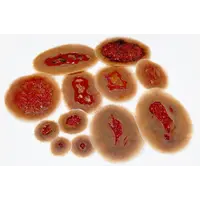 Techline Technologies Small Self Adhesive Wound Kit