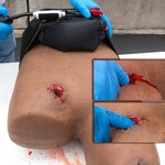 Techline Technologies Bleeding Control (B-CON) Task Trainer