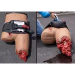 Techline Technologies Bleeding Control (B-CON) Task Trainer