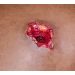 Techline Technologies Bleeding Control (B-CON) Task Trainer