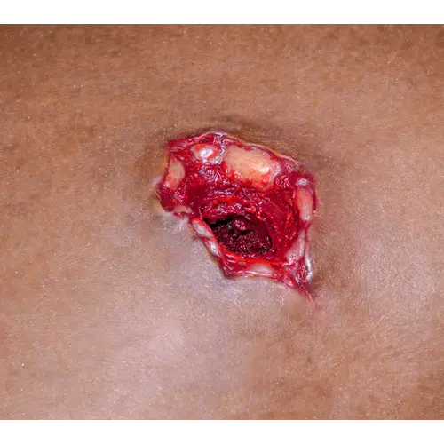 Techline Technologies Bleeding Control (B-CON) Task Trainer
