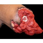 Techline Technologies Bleeding Control (B-CON) Task Trainer