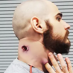 Techline Technologies GSW Neck Wound