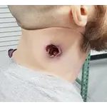 Techline Technologies GSW Neck Wound