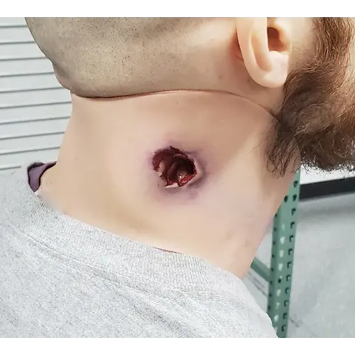 Techline Technologies GSW Neck Wound