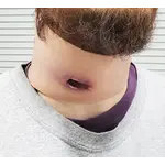 Techline Technologies GSW Neck Wound