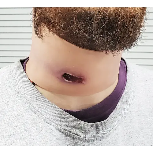 Techline Technologies GSW Neck Wound