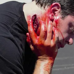 Techline Technologies Neck Wound