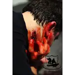 Techline Technologies Neck Wound