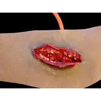 Techline Technologies Neck Wound