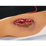 Techline Technologies Neck Wound