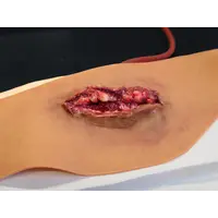 Techline Technologies Neck Wound