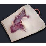 Techline Technologies Avulsion to Calf