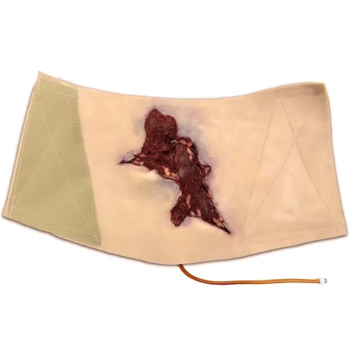 Techline Technologies Avulsion to Calf