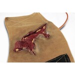 Techline Technologies Avulsion to Calf