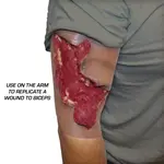 Techline Technologies Avulsion to Calf