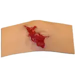 Techline Technologies Avulsion to Calf