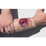 Techline Technologies Compound Arm Fracture
