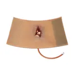 Techline Technologies Compound Arm Fracture