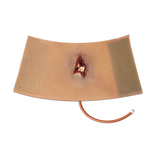 Techline Technologies Compound Arm Fracture