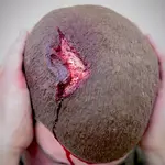 Techline Technologies Open Wound Scalp