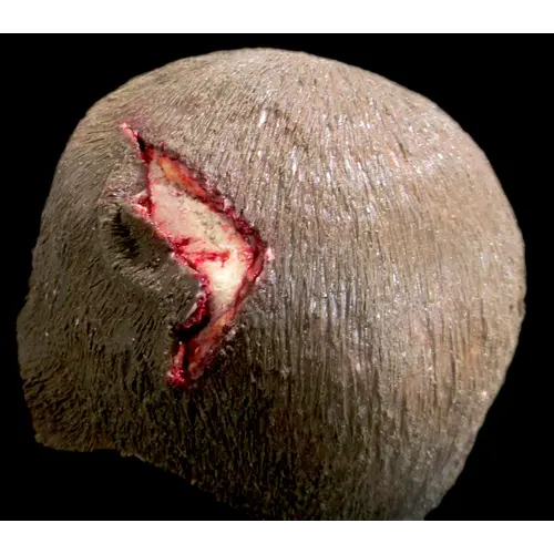 Techline Technologies Open Wound Scalp