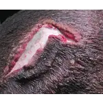 Techline Technologies Open Wound Scalp