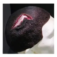 Techline Technologies Open Wound Scalp