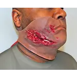 Techline Technologies Broken Jaw w/ Laceration