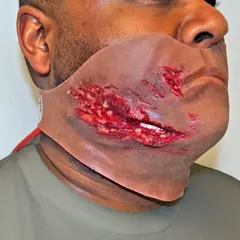 Techline Technologies Broken Jaw w/ Laceration