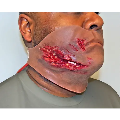 Techline Technologies Broken Jaw w/ Laceration