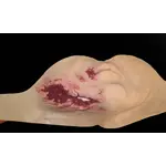 Techline Technologies Broken Jaw w/ Laceration