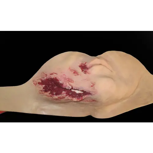 Techline Technologies Broken Jaw w/ Laceration
