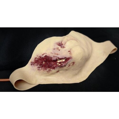 Techline Technologies Broken Jaw w/ Laceration
