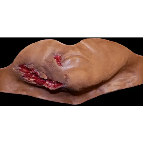 Techline Technologies Broken Jaw w/ Laceration