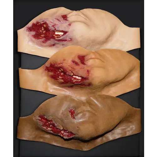 Techline Technologies Broken Jaw w/ Laceration