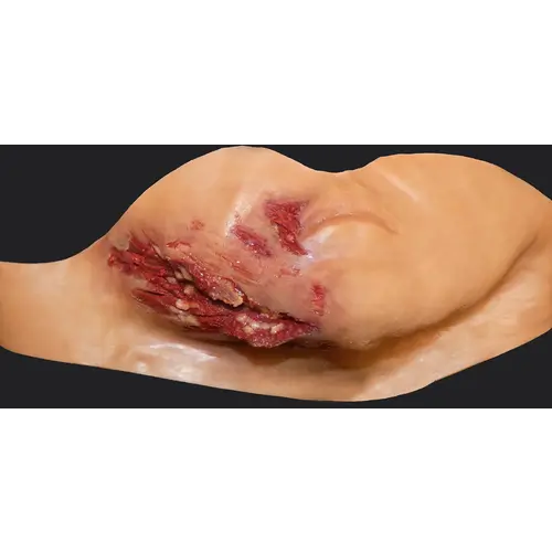 Techline Technologies Broken Jaw w/ Laceration