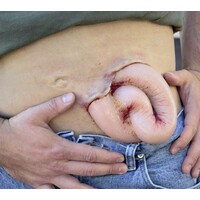 Techline Technologies Evisceration