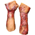 Techline Technologies Severe Right Burn Glove