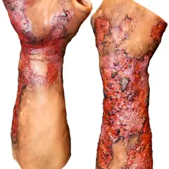 Techline Technologies Severe Right Burn Glove