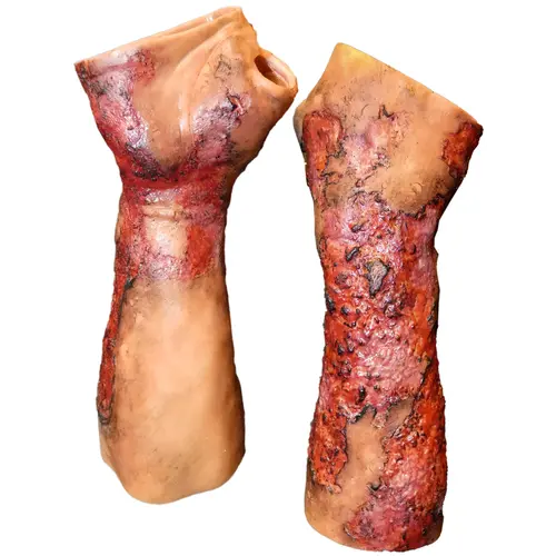 Techline Technologies Severe Right Burn Glove