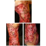 Techline Technologies Severe Right Burn Glove