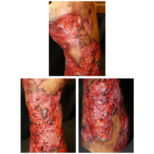 Techline Technologies Severe Right Burn Glove