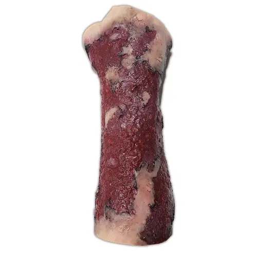 Techline Technologies Severe Right Burn Glove