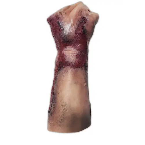 Techline Technologies Severe Right Burn Glove