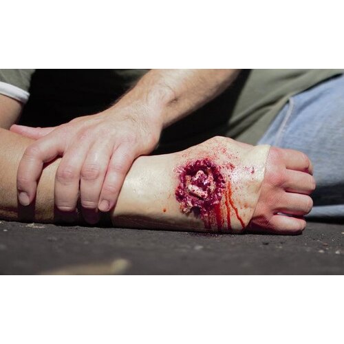 Techline Technologies GSW Through Right Hand