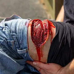 Techline Technologies Thigh Laceration