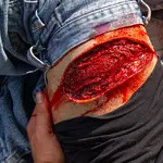 Techline Technologies Thigh Laceration