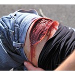 Techline Technologies Thigh Laceration
