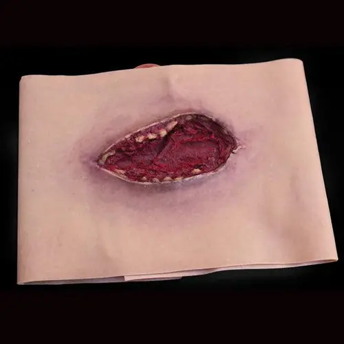 Techline Technologies Thigh Laceration